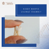 Kiedy warto usunąć ósemki?